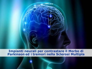 Impianti neurali per contrastare il Morbo di
Parkinson ed i tremori nella Sclerosi Multipla
 