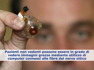 Pazienti non vedenti possono essere in grado di
vedere immagini grezze mediante utilizzo di
computer connessi alle fibre del nervo ottico
 