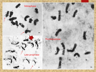 Late prophase
Prometaphase
Metaphase
 