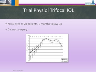 Trial Physiol Trifocal IOL
 N=40 eyes of 20 patients, 6 months follow-up
 Cataract surgery
Alio et al, JRS 2013
 