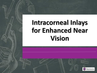 Intracorneal Inlays
for Enhanced Near
Vision
 