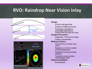 RVO: Raindrop Near Vision Inlay
Stromal Cushion
100 µm
• Design:
– A 2mm hydrogel inlay
– Create a multifocal cornea
– Proprietary hydrogel is
permeable allowing for
nutrient flow through the inlay
• Surgical Procedure:
– Implanted ~150 microns deep
– Under a corneal flap
• Method of Action:
– Central 2mm provides near
vision
– Results in a 2-3mm central
corneal steepening
– Peripheral cornea provides
distance
– Transition zone provides
intermediate vision
• Patient Candidates:
– Emmetropes
 