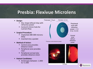Presbia: Flexivue Microlens
 Design:
 Disc shape bifocal inlay with
refractive power
 Central 0.15mm hole for
nutrient flow
 Surgical Procedure:
 Implanted 280-300 microns
deep
 Inserted into a pocket
 Method of Action:
 Central zone provides
distance vision
 Peripheral zone provides
near
 Peripheral corneal also
provides distance vision
 Patient Candidates:
 Ametropes between -1.00D
to +1.50D
Thickness*: 15 µm Diameter: 3.2 mm
Peripheral
zone with
refractive
power: +1.5
D to +3.5 D
Central
zone
without
refractive
power
*Thickness varies based on power
 