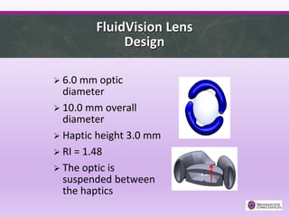 FluidVision Lens
Design
 6.0 mm optic
diameter
 10.0 mm overall
diameter
 Haptic height 3.0 mm
 RI = 1.48
 The optic is
suspended between
the haptics
 