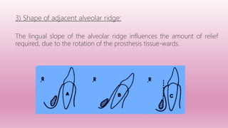 MANDIBULAR MAJOR CONNECTORS | PPTX
