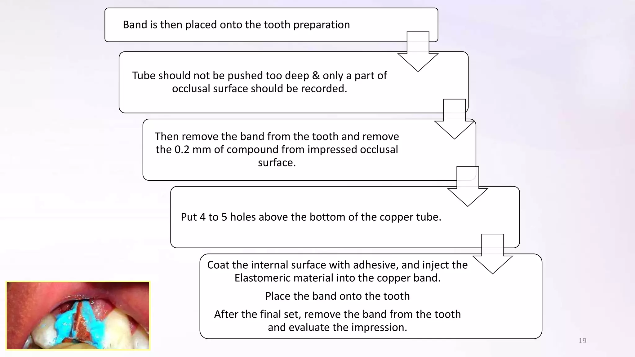 Fixed Impression Impression Techniques in Fixed partial denture | PPTX