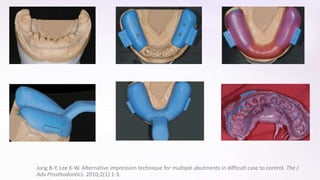 Fixed Impression Impression Techniques in Fixed partial denture | PPTX