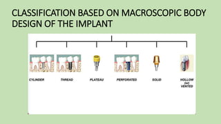 CLASSIFICATION BASED ON MACROSCOPIC BODY
DESIGN OF THE IMPLANT
 