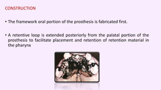CLEFT LIP AND PALATE | PPTX
