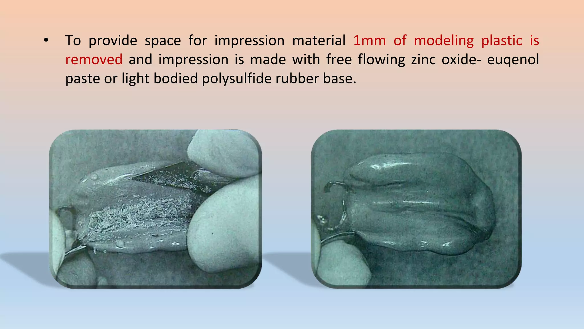 • To provide space for impression material 1mm of modeling plastic is
removed and impression is made with free flowing zinc oxide- euqenol
paste or light bodied polysulfide rubber base.
 