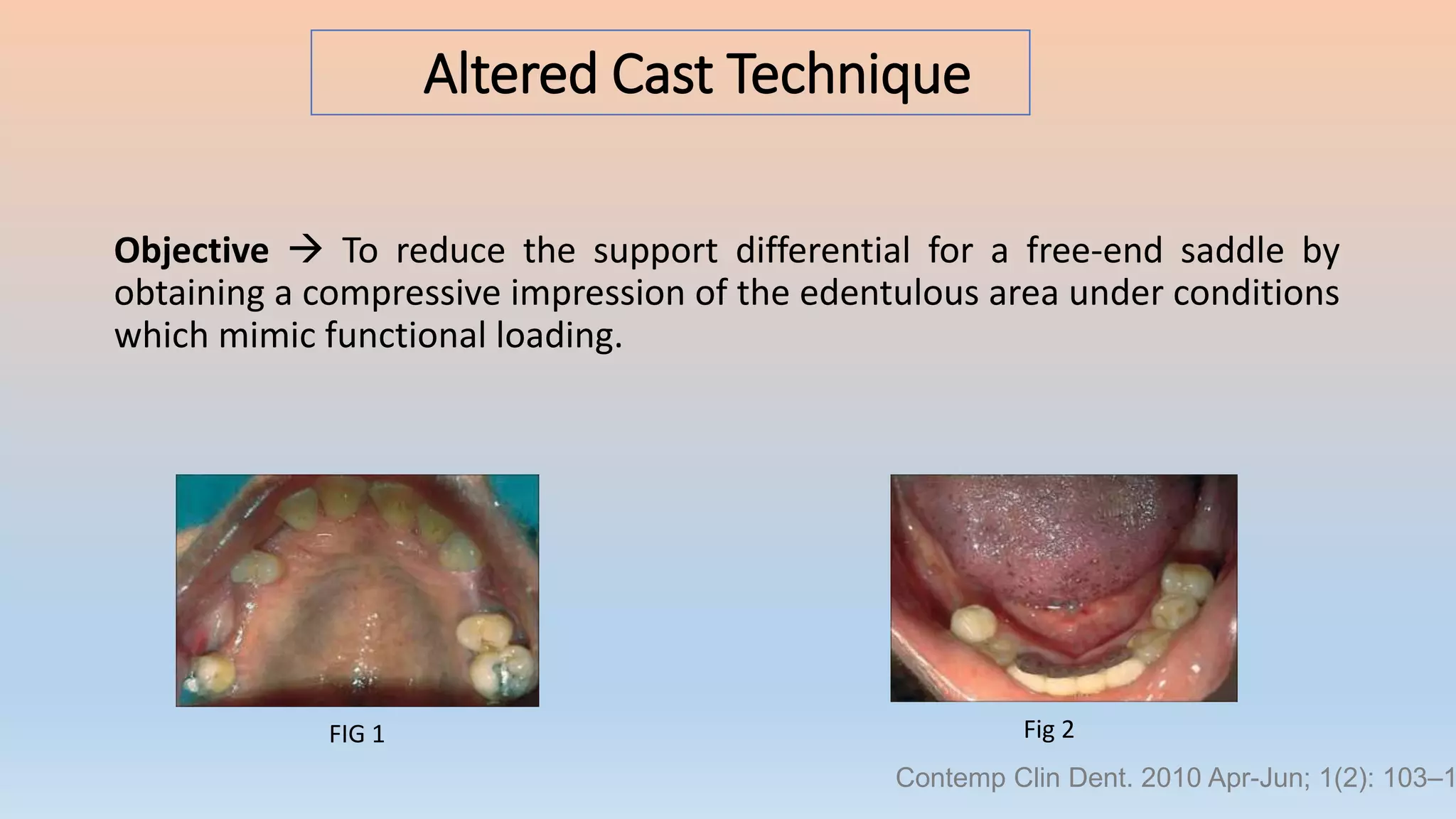 Altered Cast Technique
FIG 1 Fig 2
Contemp Clin Dent. 2010 Apr-Jun; 1(2): 103–1
Objective  To reduce the support differential for a free-end saddle by
obtaining a compressive impression of the edentulous area under conditions
which mimic functional loading.
 