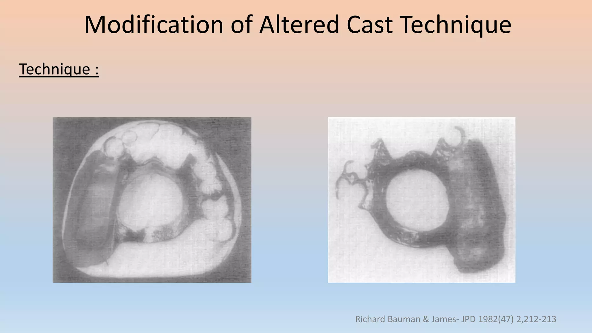 Modification of Altered Cast Technique
Technique :
Richard Bauman & James- JPD 1982(47) 2,212-213
 