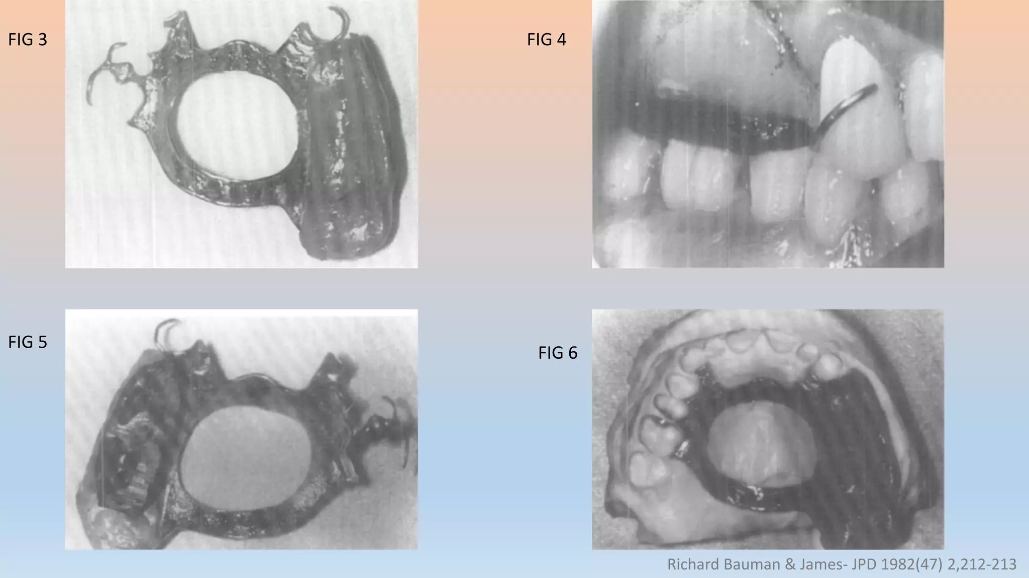 FIG 3 FIG 4
FIG 5
FIG 6
Richard Bauman & James- JPD 1982(47) 2,212-213
 