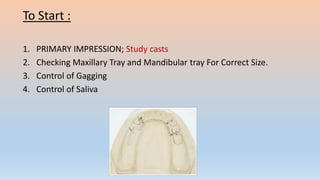 To Start :
1. PRIMARY IMPRESSION; Study casts
2. Checking Maxillary Tray and Mandibular tray For Correct Size.
3. Control of Gagging
4. Control of Saliva
 
