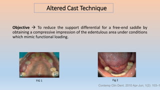 Altered Cast Technique
FIG 1 Fig 2
Contemp Clin Dent. 2010 Apr-Jun; 1(2): 103–1
Objective  To reduce the support differential for a free-end saddle by
obtaining a compressive impression of the edentulous area under conditions
which mimic functional loading.
 