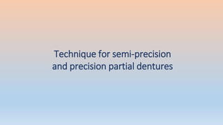 Technique for semi-precision
and precision partial dentures
 