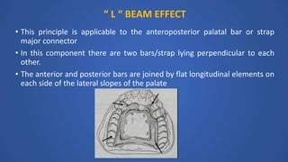 “ L “ BEAM EFFECT
• This principle is applicable to the anteroposterior palatal bar or strap
major connector
• In this component there are two bars/strap lying perpendicular to each
other.
• The anterior and posterior bars are joined by flat longitudinal elements on
each side of the lateral slopes of the palate
 