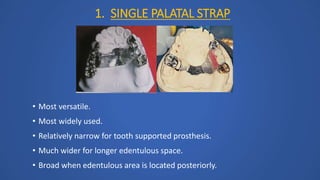 1. SINGLE PALATAL STRAP
• Most versatile.
• Most widely used.
• Relatively narrow for tooth supported prosthesis.
• Much wider for longer edentulous space.
• Broad when edentulous area is located posteriorly.
 