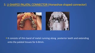3. U-SHAPED PALATAL CONNECTOR (Horseshoe shaped connector)
 It consists of thin band of metal running along posterior teeth and extending
onto the palatal tissues for 6-8mm.
 