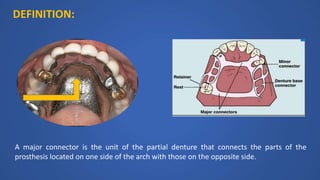 DEFINITION:
A major connector is the unit of the partial denture that connects the parts of the
prosthesis located on one side of the arch with those on the opposite side.
 