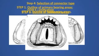 STEP 1. Outline of primary bearing areas:
STEP 2. Outline of nonbearing areas.STEP 3: Outline of connector areas
Step 4: Selection of connector type
STEP 5 : Unification
 