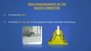 IDEAL REQUIREMENTS OF THE
MAJOR CONNECTOR
1. It should be rigid.
2. It should not impinge on free gingival margin and other soft tissues.
 