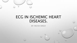 ECG IN ISCHEMIC HEART
DISEASES.
BY-RICHA SINGH
 