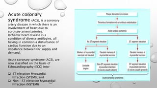 Richa singh ecg in ischemic heart disease | PPTX