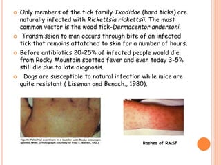Tick Rmsf Rash Medical Microbiology :Richettsia or rickettsiae | PPTX