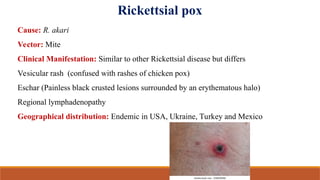Ricketta Rash Rickkettesia powerpoint presentation for msc | PPT