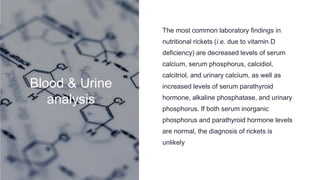 Rickets-1.pptx........................... | PPTX