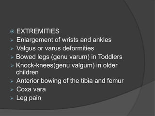 Muscle weakness (especially proximal)    
