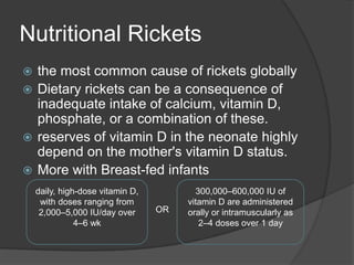 Valgus or varus deformities    