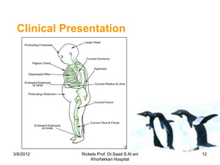 Clinical Presentation




3/8/2012     Rickets Prof. Dr.Saad S Al ani   12
                 Khorfakkan Hospital
 