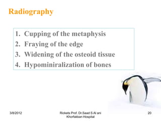Radiography

   1.      Cupping of the metaphysis
   2.      Fraying of the edge
   3.      Widening of the osteoid tissue
   4.      Hypominiralization of bones




3/8/2012              Rickets Prof. Dr.Saad S Al ani   20
                          Khorfakkan Hospital
 