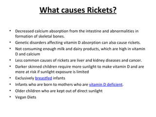 Rickets | PPT