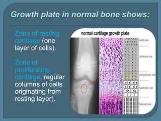  Zone of resting
cartilage (one
layer of cells).
 Zone of
proliferating
cartilage: regular
columns of cells
originating from
resting layer).
 