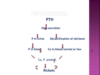 PTH
High secretion
P in urine Decalcification of old bone
P in blood Ca in blood normal or low
Ca, P product
Rickets
 