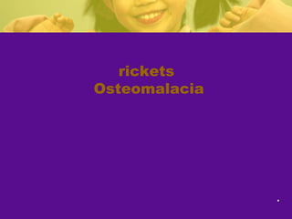 ..
rickets
Osteomalacia
 