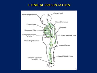 CLINICAL PRESENTATION
 