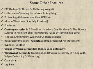 Some Other Features
 FTT (Failure To Thrive Or Flattering Weight)
 Listlessness (Showing No Interest In Anything)
 Protruding Abdomen, umbilical HERNIA
 Muscle Weakness (Specially Proximal)
 Fractures
 Craniosynostosis- Is A Condition In Which One Or More Of The Fibrous
Sutures In An Infant Skull Prematurely Fuses By Turning Into Bone
 Thoracic Asymmetry, Widening Of Thoracic Bone
 Respiratory Infections, Atelectasis (Impairment Of Air Movement)
 Kyphosis, Lordosis
 Valgus Or Varus Deformities (Knock knee deformity)
 Windswept Deformity (combination Of Varus Deformity Of 1 Leg With
Valgus Deformity Of Other Leg)
 Coxa Vara
 Leg Pain
 