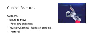 Clinical Features
GENERAL –
- Failure to thrive
- Protruding abdomen
- Muscle weakness (especially proximal)
- Fractures
 
