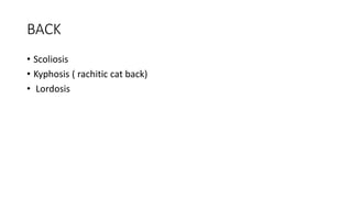 BACK
• Scoliosis
• Kyphosis ( rachitic cat back)
• Lordosis
 