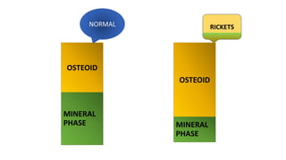 OSTEOID
MINERAL
PHASE
OSTEOID
MINERAL
PHASE
RICKETS
NORMAL
 