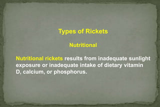 Mervin Rickets RICKETS .ppt