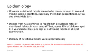 General Overview of Rickets by Dr. JOA- KBTH.pdf
