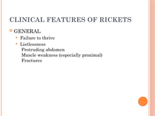 CLINICAL FEATURES OF RICKETS
 GENERAL
 Failure to thrive
 Listlessness
Protruding abdomen
Muscle weakness (especially proximal)
Fractures
 