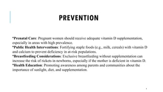 Rickets Health Risk RICKETS AND THE PHYSIOTHERAPY TREATMENT.pptx