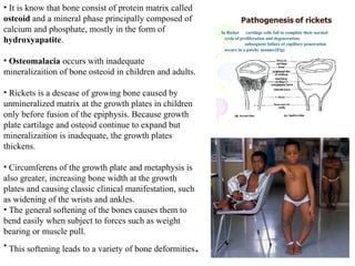 Modern issues about rickets in children. | PPT
