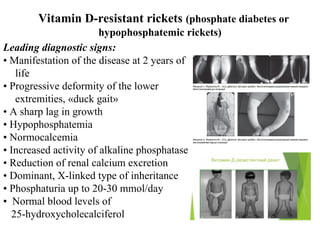 Blood Ph Rickets Modern issues about rickets in children. | PPT